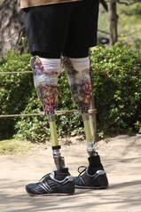 義足　両足 両足義足の歩行に関して簡単に説明。重心移動は上半身で行っています